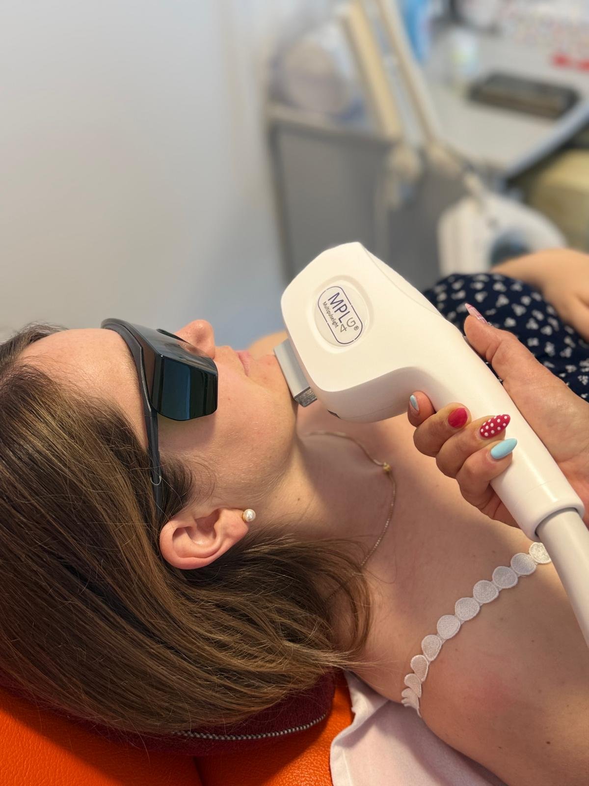 MPL4-Behandlung im Gesicht bei Schoch Cosmetic